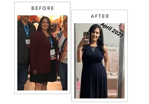 Before and after bariatric surgery results - Anonymous, Tucson, Arizona