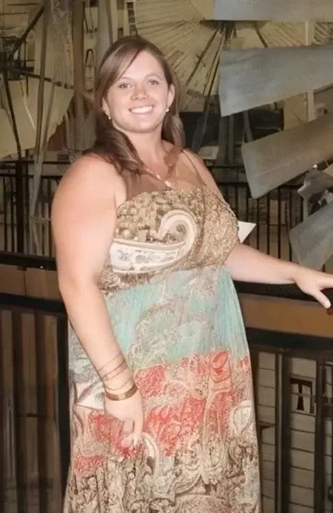 Before - weight regain after gastric sleeve