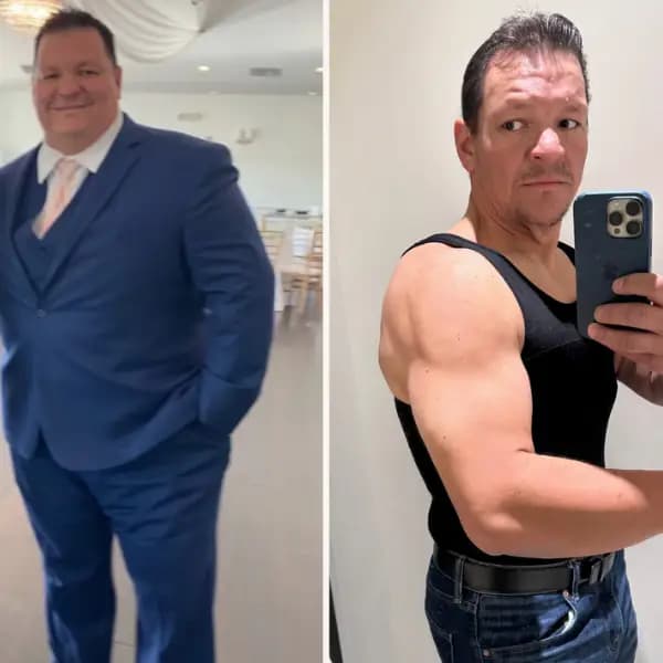 Patient transformation - male