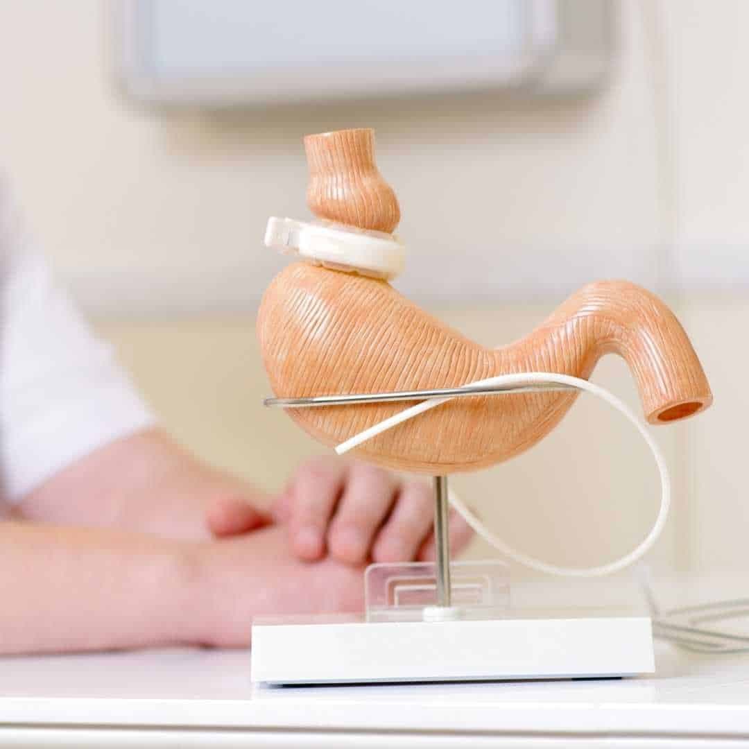 Is there a standard bougie size?