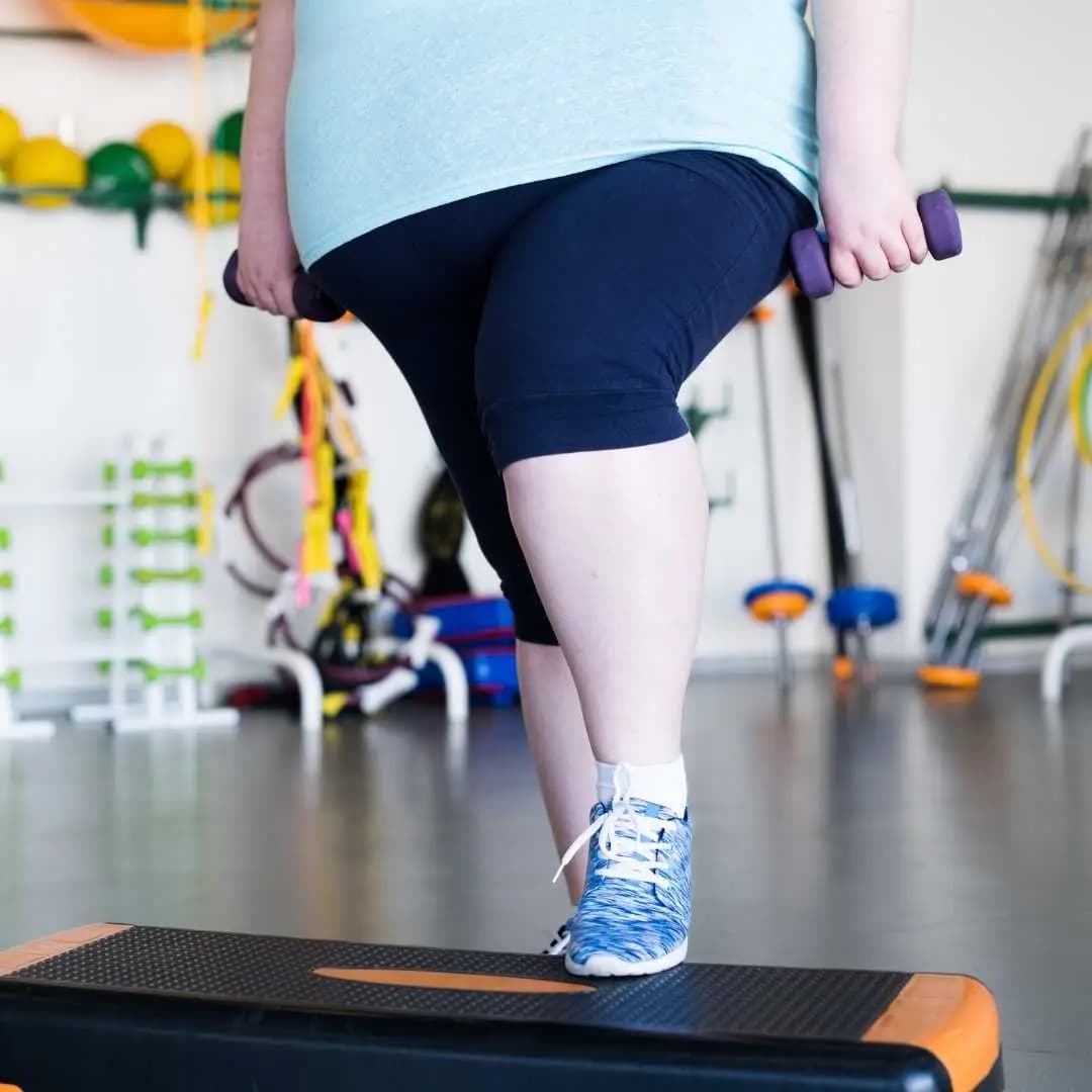 I had poor weight loss after SADI. Should I have a revision?